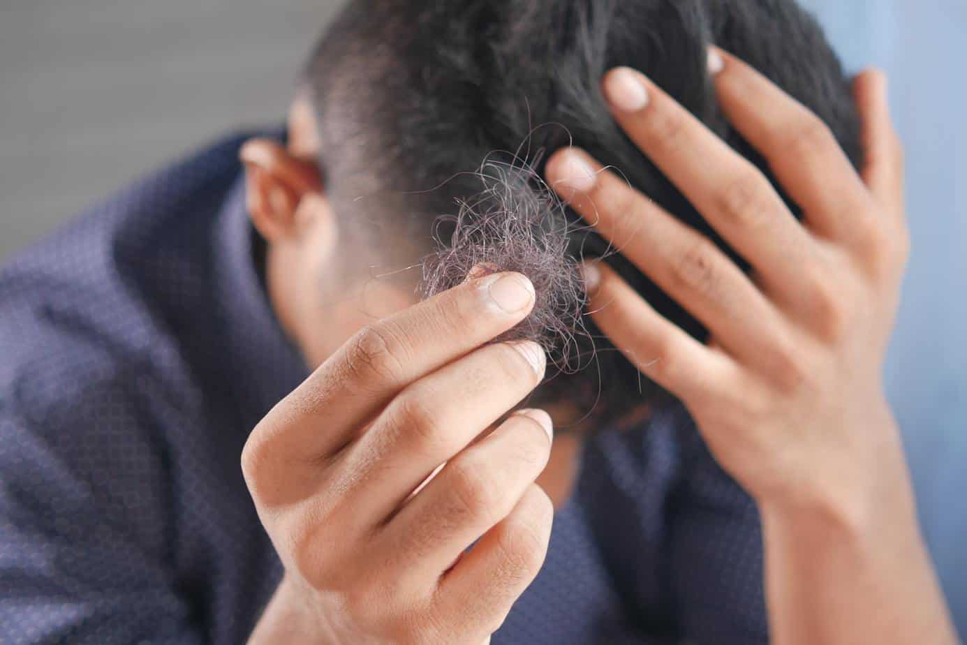 Causes of excessive hair loss